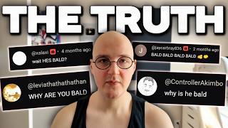 The Real Reason I am Bald...