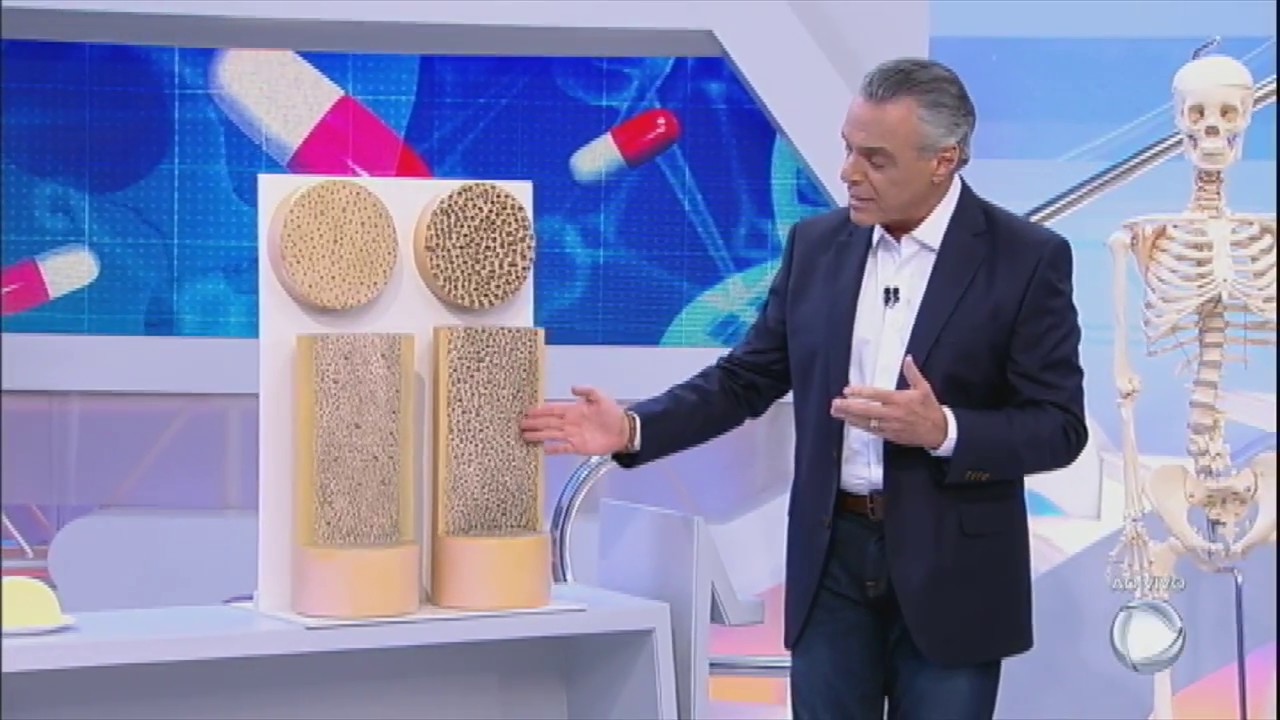 Você e o Doutor: conheça causas e sintomas da osteoporose