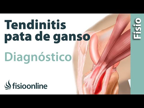 download lagu mp3 mp4 Pata De Ganso, download lagu Pata De Ganso gratis, unduh video klip Pata De Ganso
