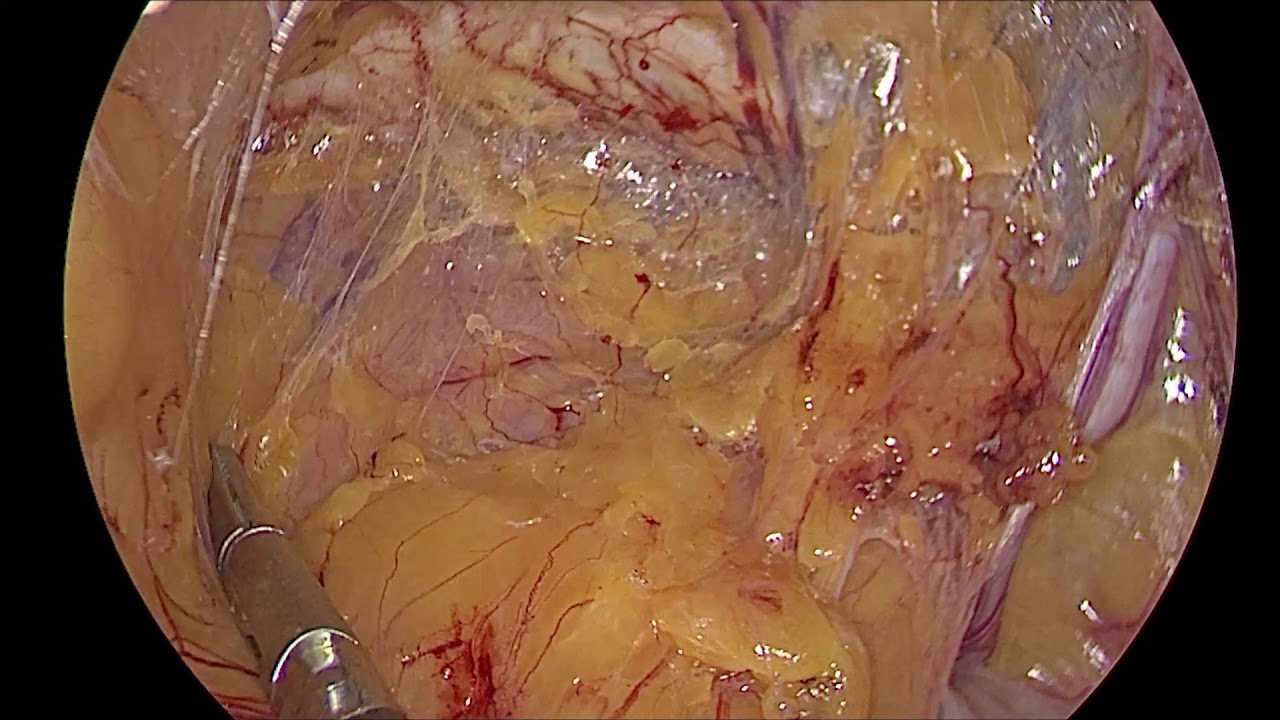 Flavio Rody Da Silva Vianna-0