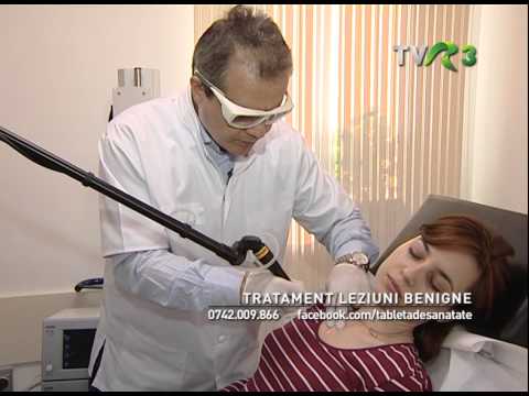 Helminthic therapy treatment