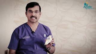 About Osteoarthritis  Dr Shiva Reddy Orthopaedic S