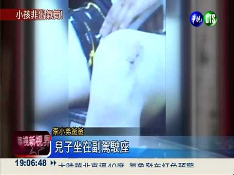 偏心不疼長子 狠母滾水潑傷兒