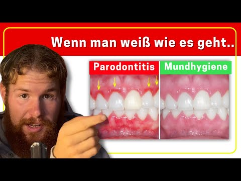 How I saved my teeth and gums (7-step method)
