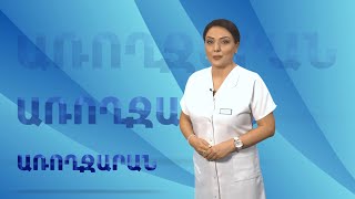 Առողջարան 24.06.2021 // Ամենը արյունատվության մասին