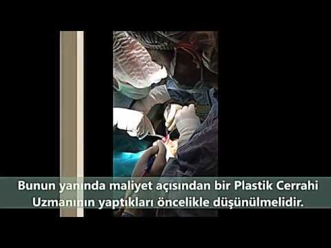 Antalya-BURUN Estetiğini Kimler Yapar | Op Dr Gökhan Özerdem
