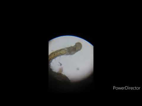 Detritus Worm Under Microscope