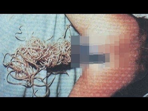 Parassiti di vermi a uccelli Nimazol per un lyambliya
