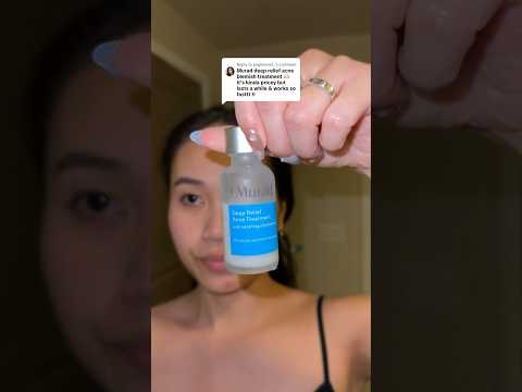 Does this murad acne treatment WORK?? 🫣 #acnetreatment #murad