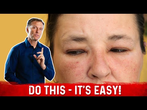 Adrenal Fatigue Is Cortisol Responsible for Your Diabetes Dr Berg