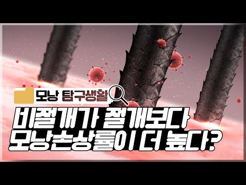 의느님답변????ㅣ비절개가 절개보다 모낭손상률이 더 높다는말 사실인가요?ㅣ모발이식ㅣ모낭손상ㅣ다나성형외과(DANA)