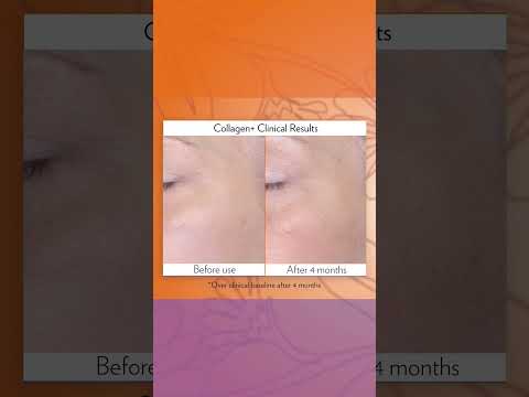 BEAUTY FOCUS COLLAGEN+ BEFORE AFTER REVIEW #collagenplus #shorts