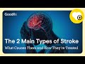 Understanding The 2 Main Types Of Stroke What Causes Them And How They Re Treated GoodRx