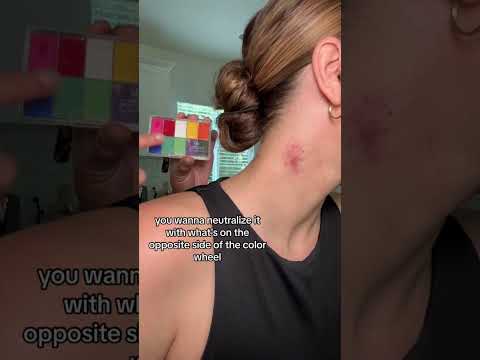 How to get rid of a hickey on your neck instantly by covering with makeup and green color corrector