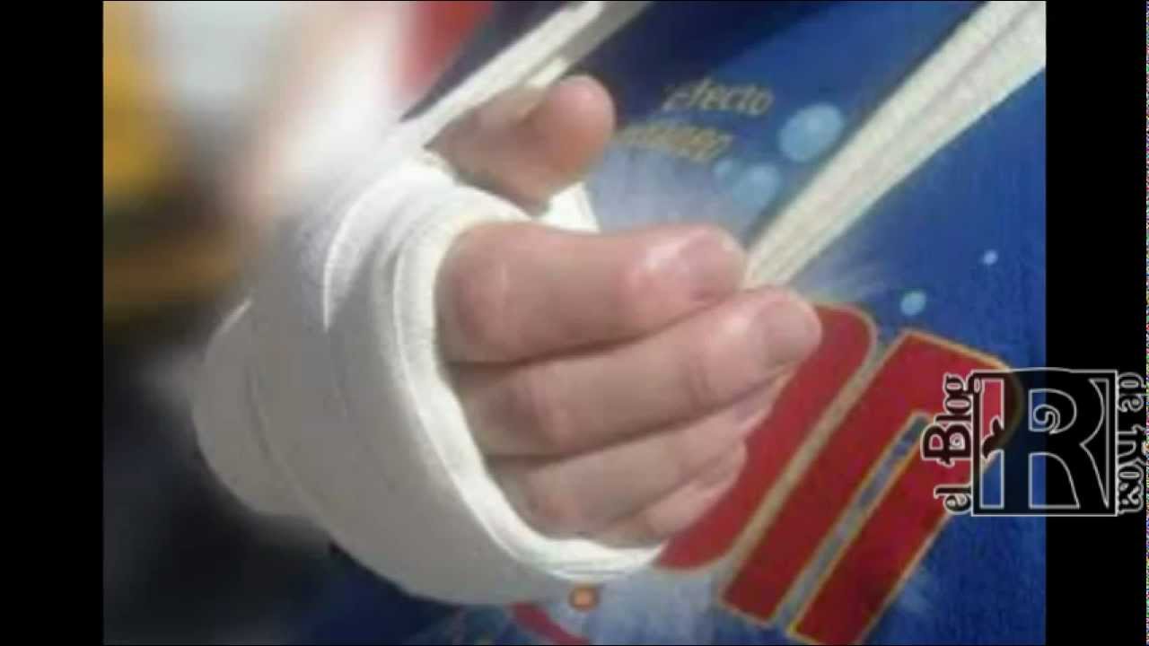 Watch Cuidados del yeso Now Cuidados del yeso