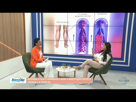Entenda o que é trombose e qual a associação entre a doença e a Covid-19 20 07 2022