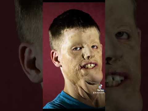 Soldados antes vs después de la guerra #shorts