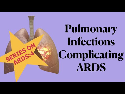 ARDS SERIES 4: Pulmonary Infection In ARDS