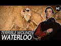 The most BRUTAL wounds from the Battle of Waterloo