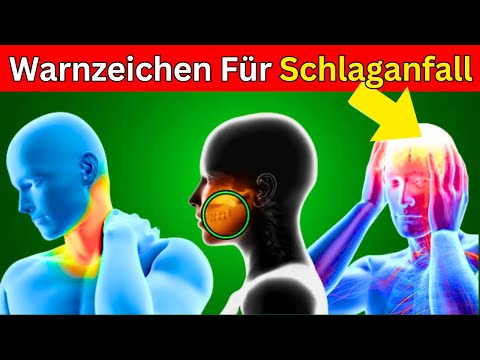 7 Symptoms of a Stroke: Early Detection and Prevention - Important Warning Signs