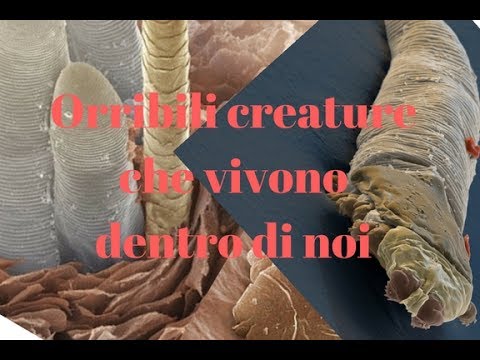 Trattamento di un parassita epatico di un sosalshchik Fotografia della pelle lyambliya
