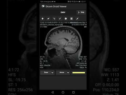 Dicom Viewer