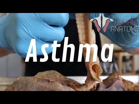 What Is Asthma, and How Is it Treated? | A Deep Look Into Respiratory Disease