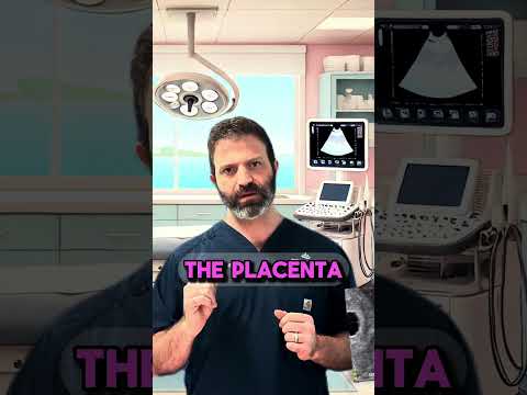 Week 5 of pregnancy #UltrasoundFindings #Week5Pregnancy  #PregnancyMilestones #DoctorExplains