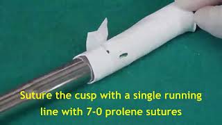 Truncus Arteriosus Repair with Hand Made PTFE Valved Conduit