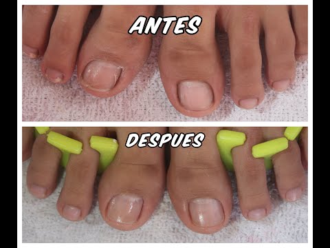 COMO HACER UN PEDICURE FACIL Y RAPIDO (bien explicado) – HOW TO PEDICURE – NLC