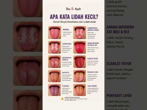 Coba Lihat Lidah Anak Sekarang, Warnanya Bisa Jadi Sinyal Kesehatan yang Penting #ibudanayah