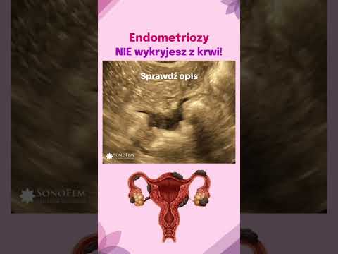 Iryna Nitefor-6