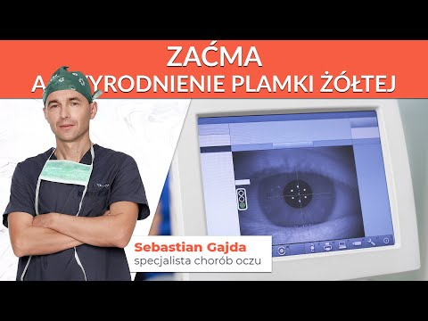 Zaćma a zwyrodnienie plamki żółtej