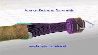 Foreskin Restoration Reverse Circumcision damage for better sex | Supercanister by Advanced Devices