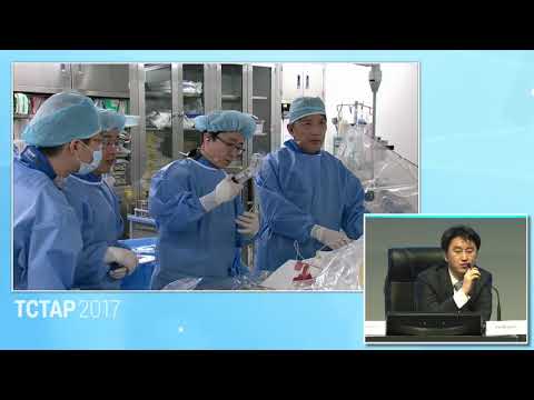 [TCTAP 2017] CTO Live - Live Case Session II