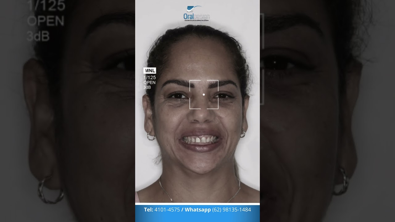 Danilo Monteiro Rezende Pereira-33