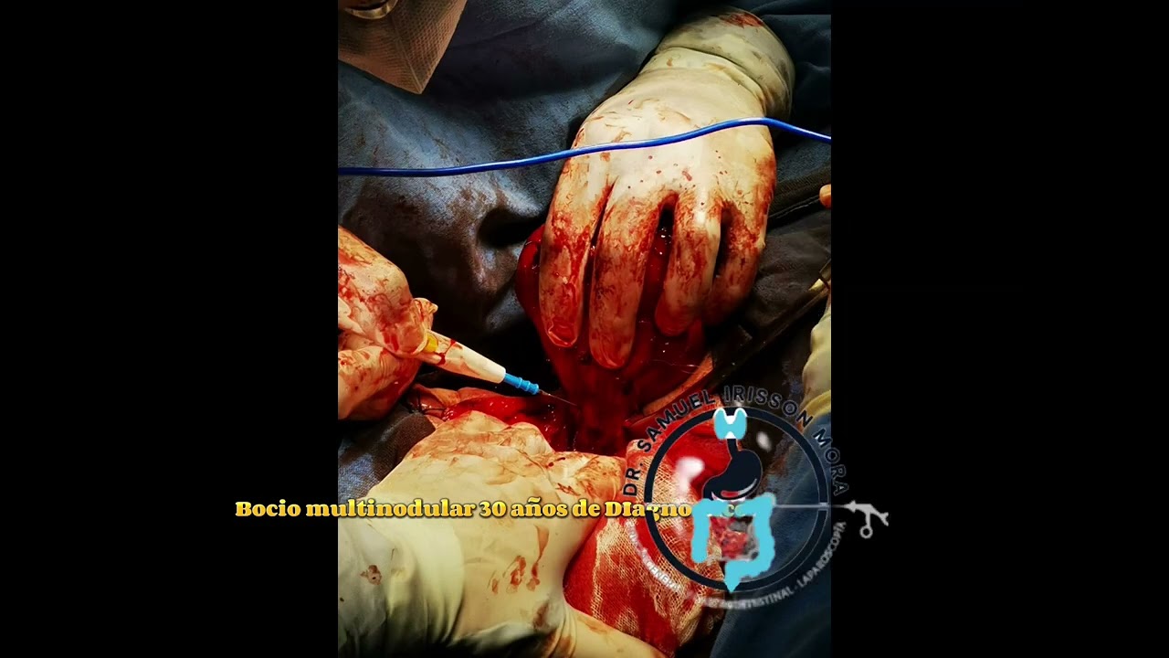 Samuel Irisson Mora-13