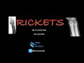 Rickets- Radiographic features