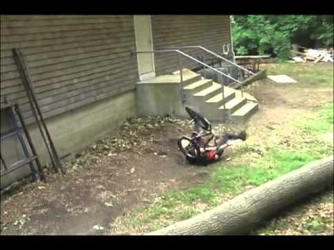 sean burns bone deth.