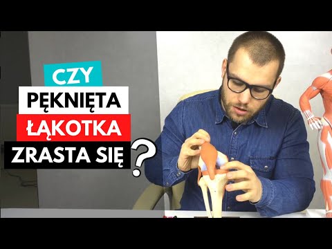 Homeopatia od koślawego Bóle kości w nogach blisko kości palca, ale nie rosną