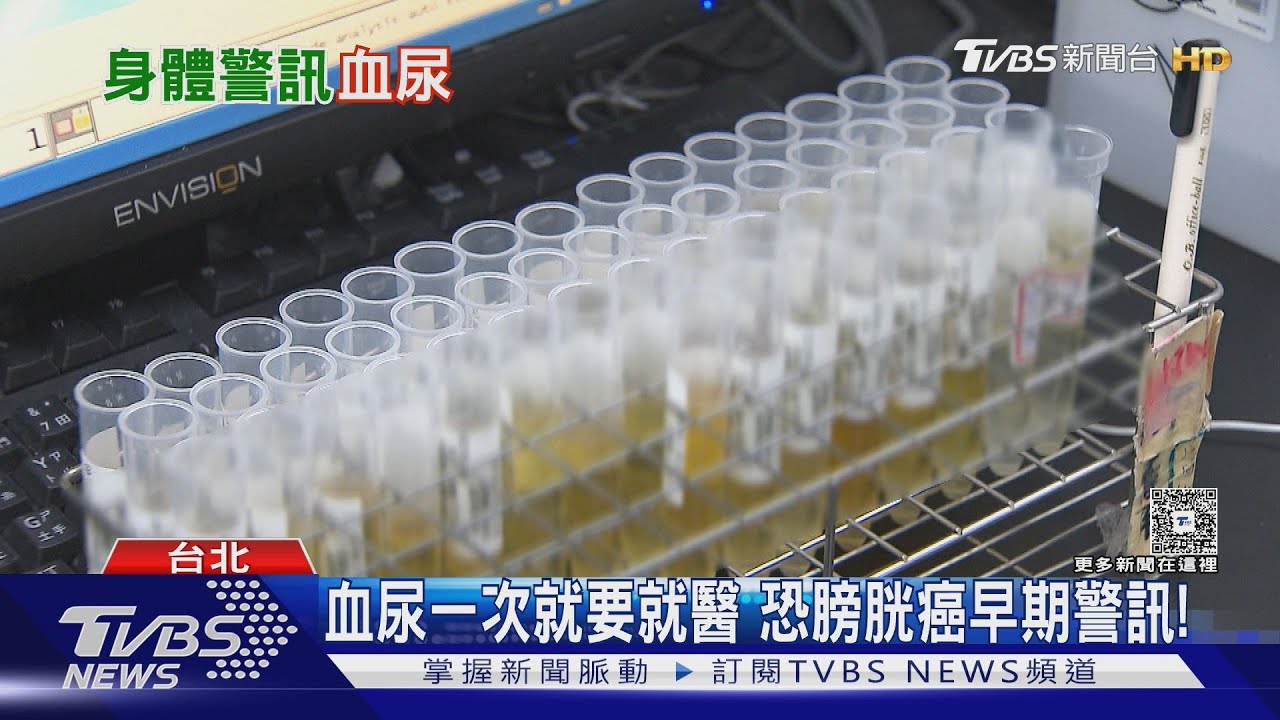 尿液變紅!先別怪火龍果 醫示警:血尿恐是癌症前兆!