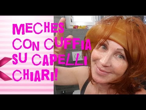 La malattia quando pigmentary nota su una faccia Perché la persona ha lentiggini