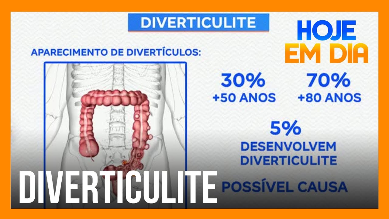 Diverticulite: saiba quais são as causas, sintomas e tratamentos