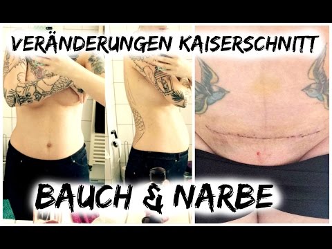 Rückenschmerzen Gefühl von Schwere in den Schultern Knieendoprothetik in Belarus
