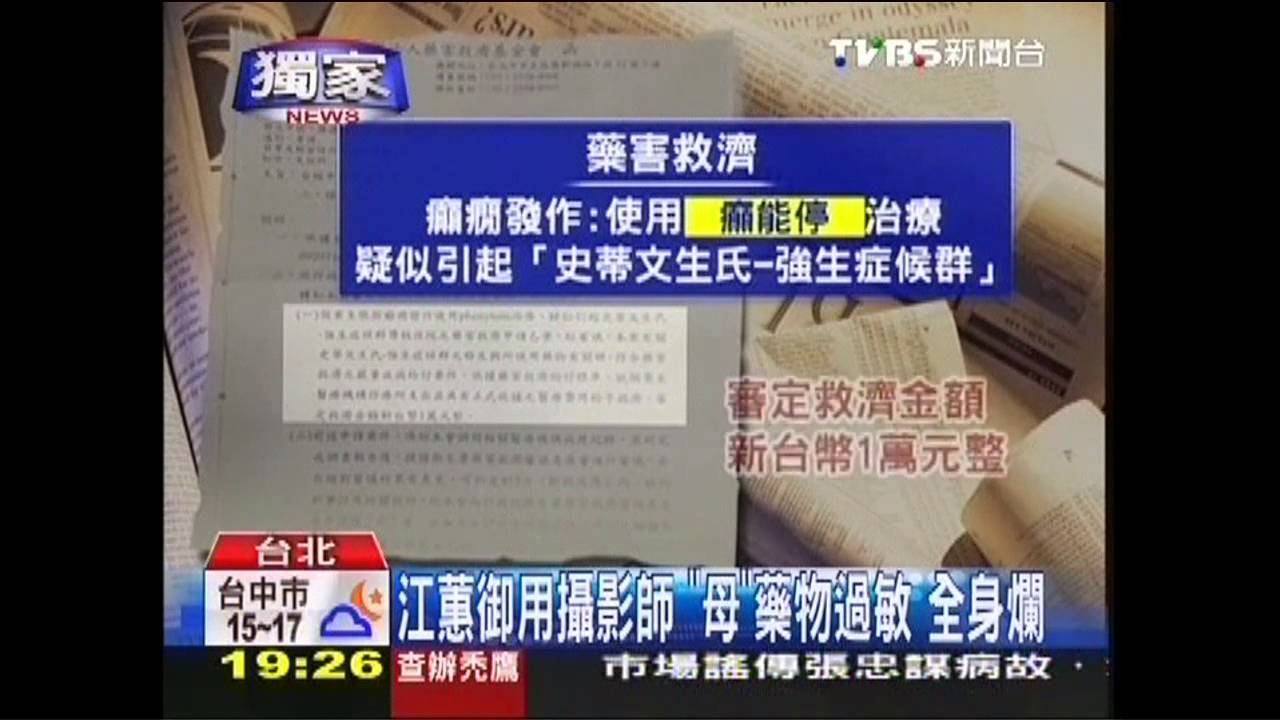 〈獨家〉江蕙御用攝影師「母」藥物過敏 全身爛