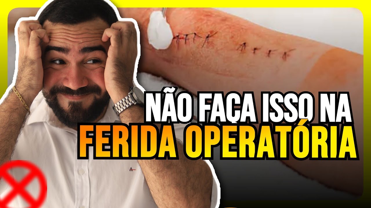 CUIDADOS COM A FERIDA OPERATÓRIA - FERIDAS E CURATIVOS