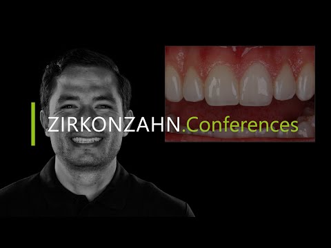 From function to aesthetics: 10 keys to success – with Dr. F. Garcia | Zirkonzahn.Conferences