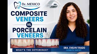 Composite Veneers vs. Porcelain Veneers | What’s the Difference