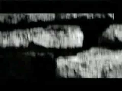 EXTRAÑO TU AMOR - BLINDAJE 10