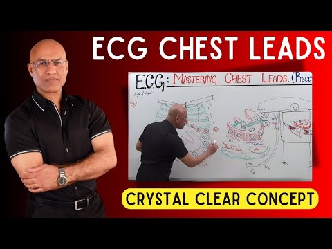 ECG Chest Leads | ECG - EKG | Cardiology